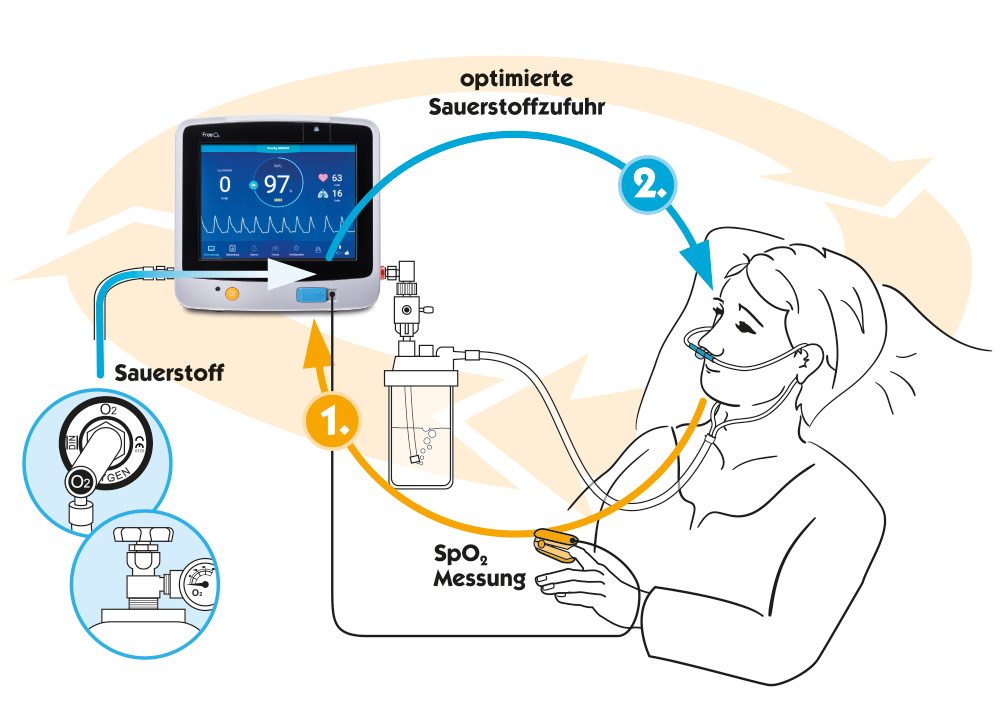 FreeO2-anwendung-schema