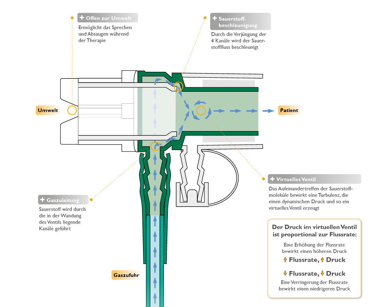 funktionsweise_cpap