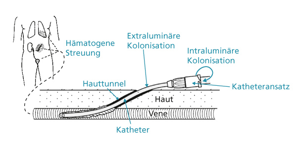 Eintritt-Bakterien-600px