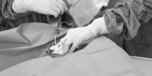 Titelbild-9 Vorteile einer EKG-gesteuerten zentralvenösen Katheterisierung