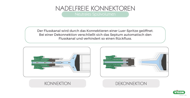 Bild04_Neutrales-Spülvolumen