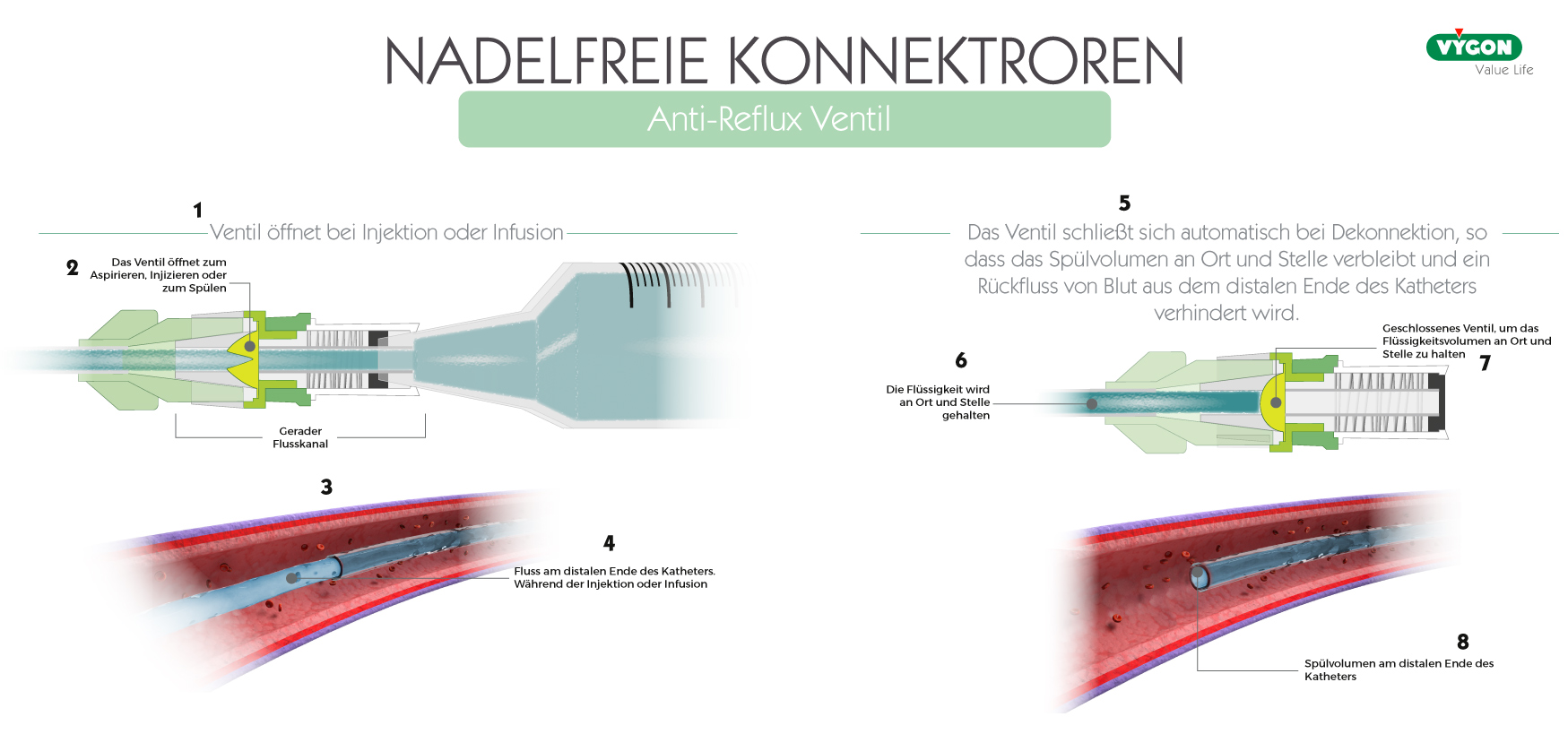 Bild05_Anti-Reflux-Ventil