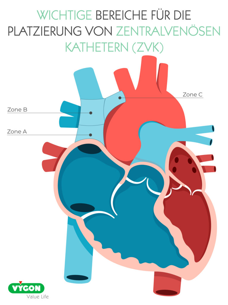 Bild01_WICHTIGE-BEREICHE-FÜR-DIE-PLATZIERUNG-VON-ZENTRALVENÖSEN-KATHETERN
