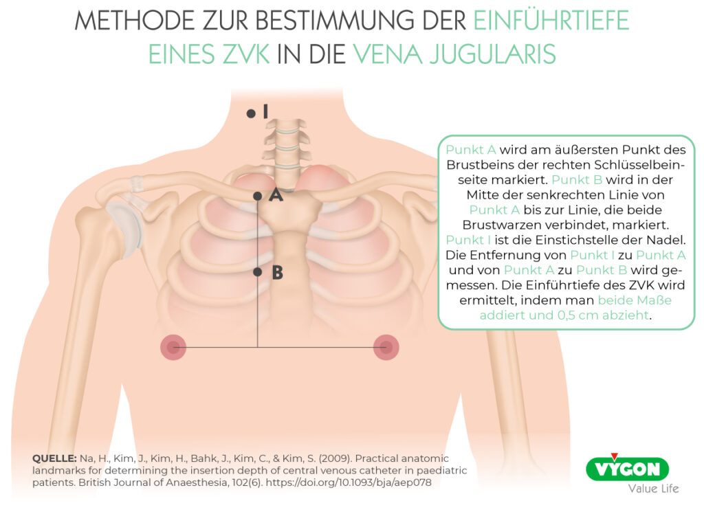 Bild03_METHODE-ZUR-BESTIMMUNG-DER-EINFÜHRTIEFE-EINES-ZVK-IN-DIE-VENA-JUGULARIS