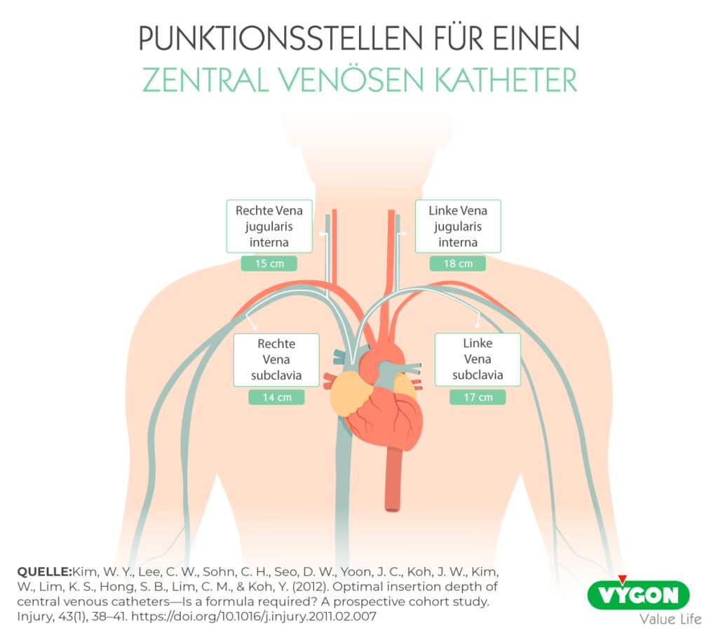 Bild07_PUNKTIONSSTELLEN-FÜR-EINEN-ZENTRAL-VENÖSEN-KATHETER