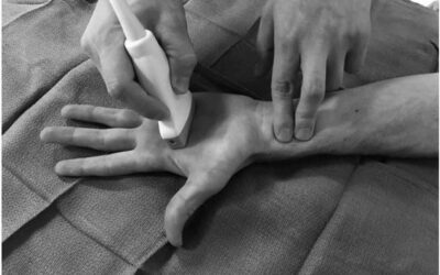 Die Bedeutung des arteriellen Zugangs in der Intensivtherapie