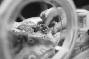 Titelbild_Kostenanalyse der modifizierten Seldinger-Technik (MST) zur Platzierung von neonatalen PICC-Kathetern